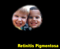 Simulation photograph: retinitis pigmentosa