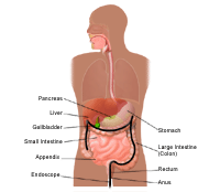 Illustration demonstrating a colonoscopy, part 1