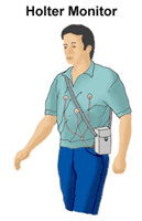 Illustration of a man wearing a Holter monitor