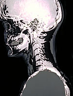 A picture of an x-ray of the head