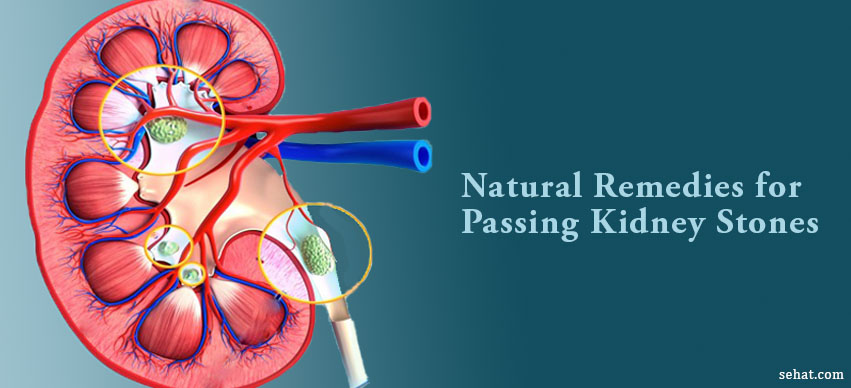 10 Effective Natural Ways of Passing Kidney Stones Fast