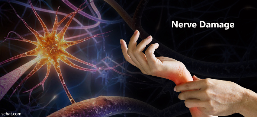 What Does Nerve Damage Feel Like?