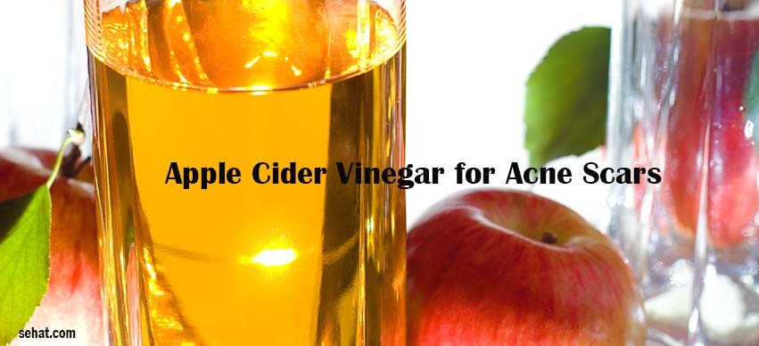 Apple Cider Vinegar for Acne Scars