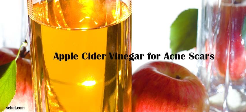 Apple Cider Vinegar for Acne Scars