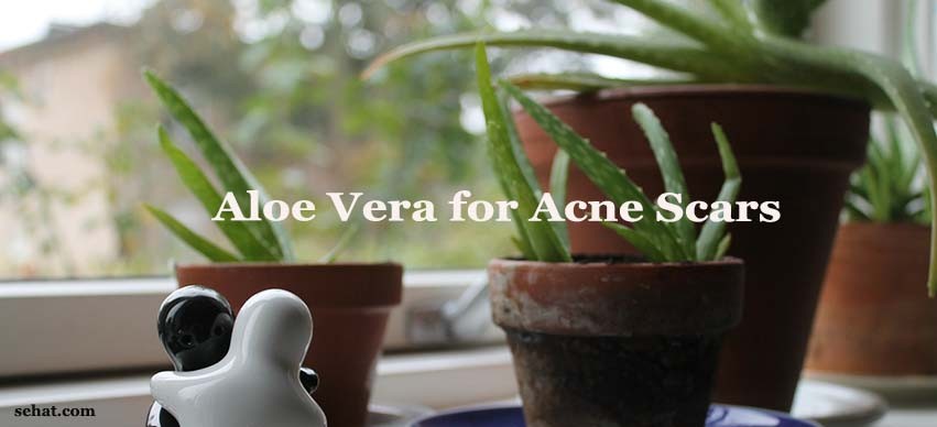 Aloe Vera and Acne Scars