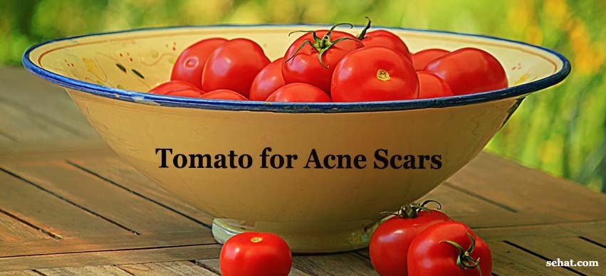 Tomatos for Acne Scars