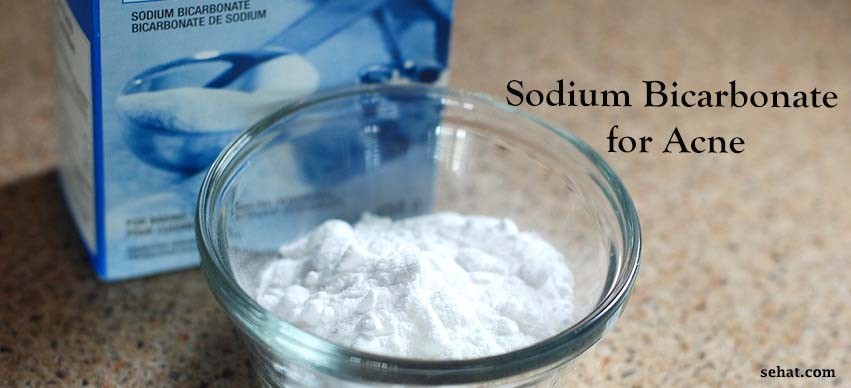 Sodium Bicarbonate for Acne