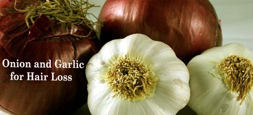 Onion and Garlic for Hair Loss