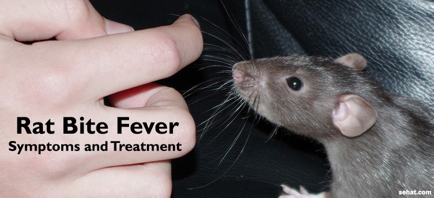 Rat Bite Fever Symptoms and Treatment 