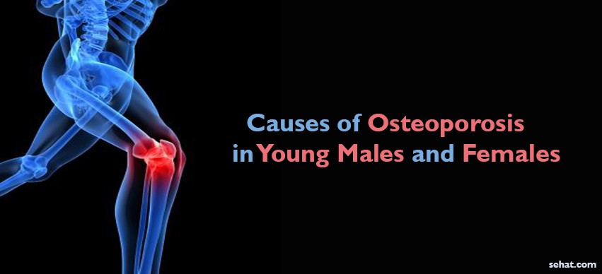 Causes of Osteoporosis in Young Males and Females
