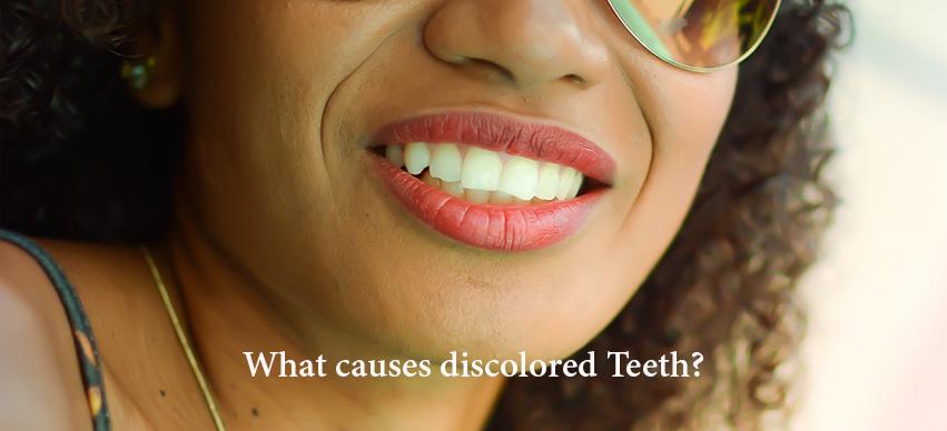 What causes discolored Teeth?