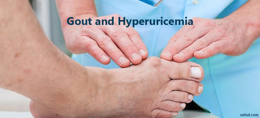 Gout and Hyperuricemia