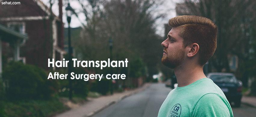 Hair Transplant After Surgery care