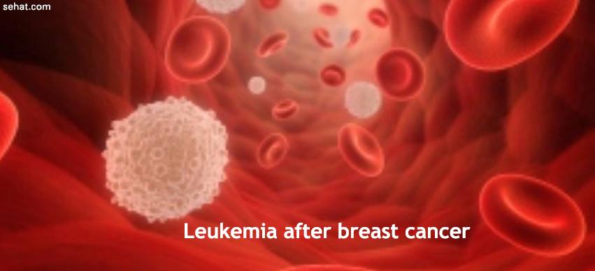 Leukemia after breast cancer