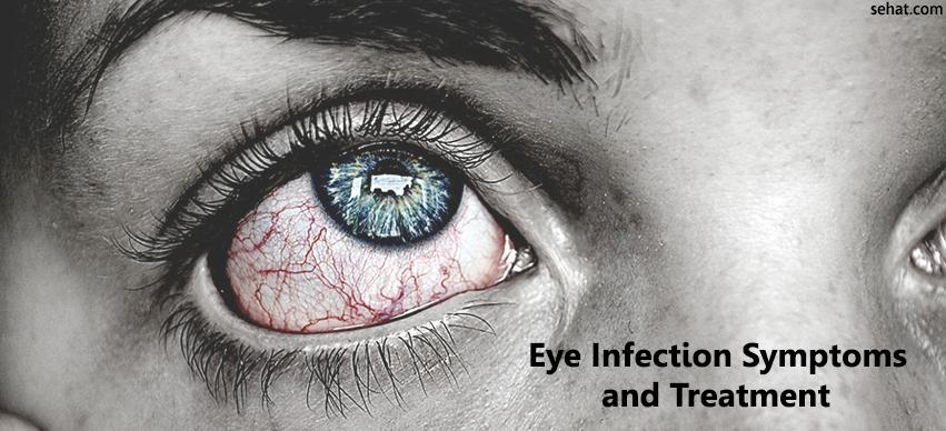 Eye Infections Symptoms and Treatment