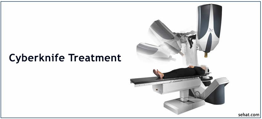 Cyberknife treatment