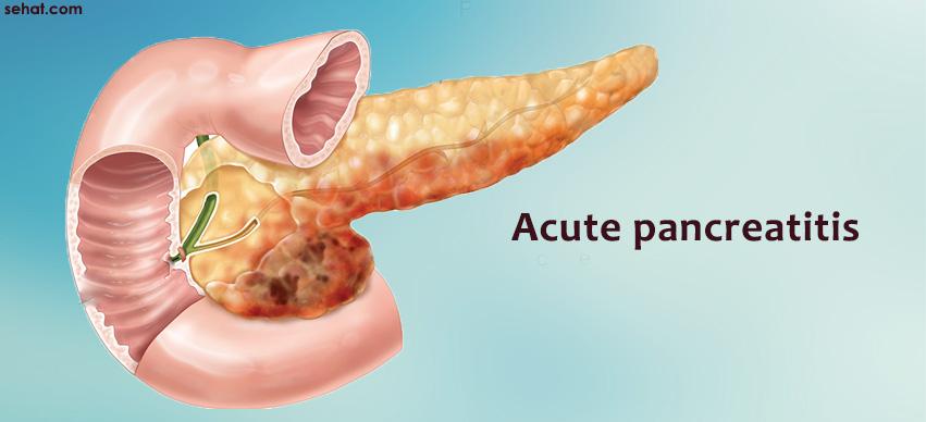 Acute pancreatitis