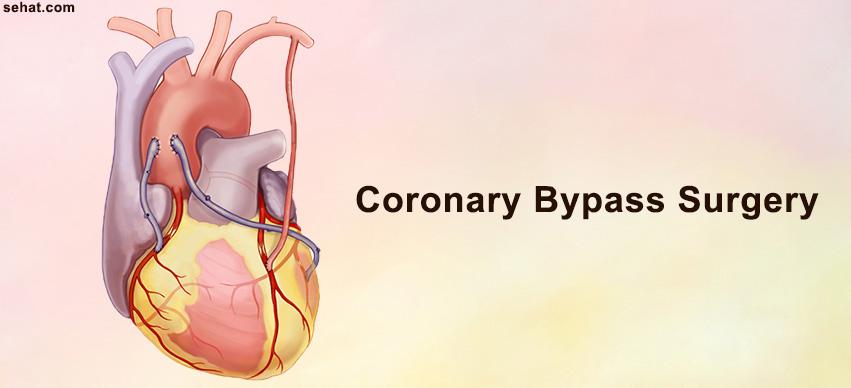 Coronary Bypass Surgery