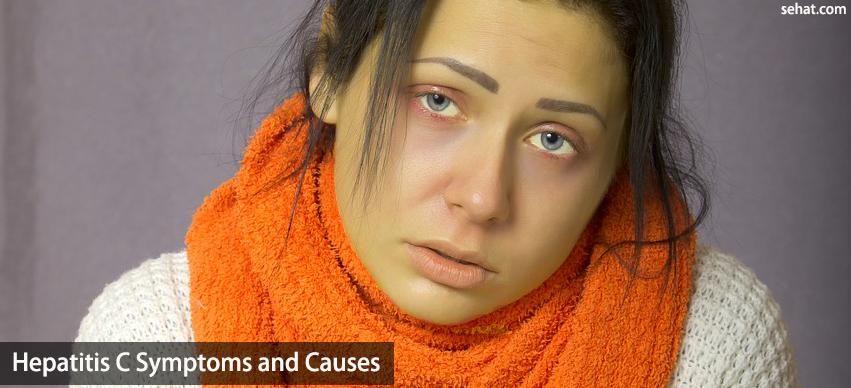 Hepatitis C symptoms and causes