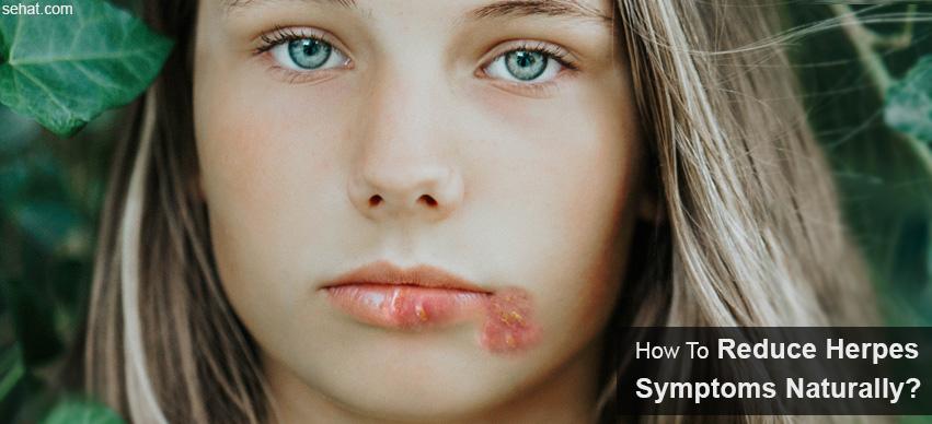 how to reduce herpes symptoms naturally