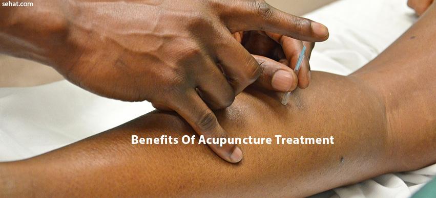 benefits of acupuncture treatment