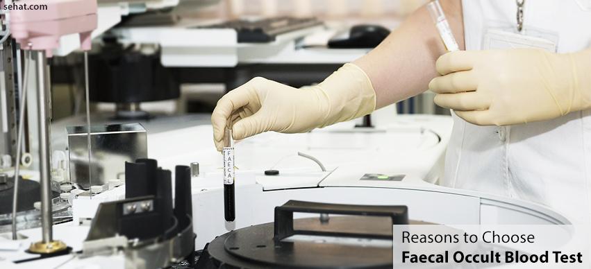 Reasons To Choose Faecal Occult Blood Test