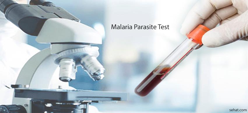 Malaria Parasite Test Procedure, Principle, Results Interpretation