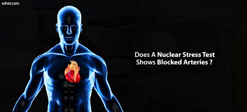 Does A Nuclear Stress Test Show Blocked Arteries