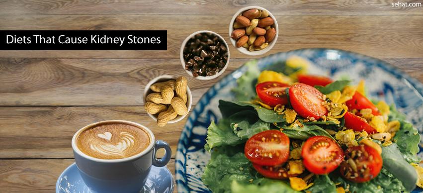 Diets that cause kidney stones