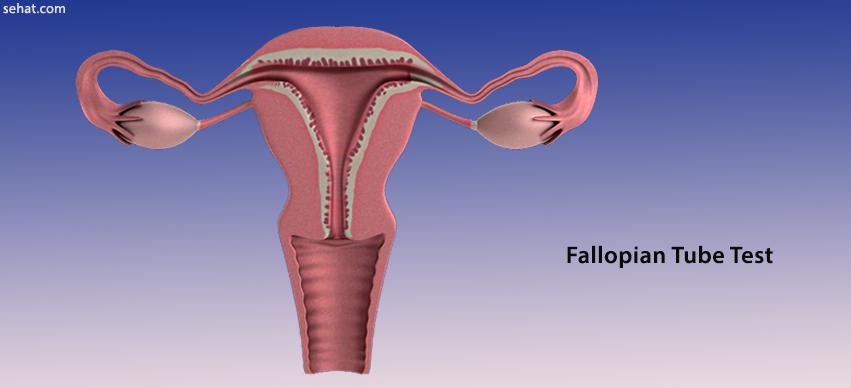 Fallopian Tube Test - Preparation, Procedure, Results, Side Effects