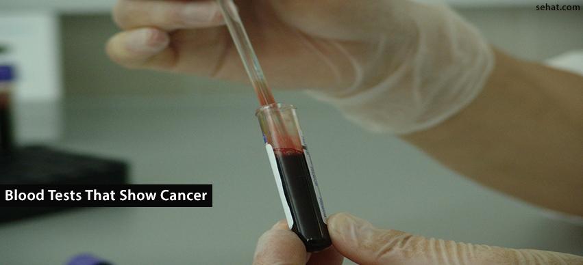 Blood tests that show cancer