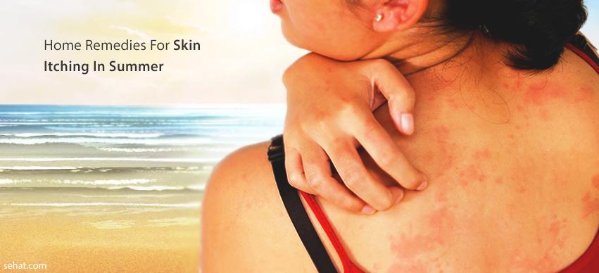 Best home remedies for skin itching in summer