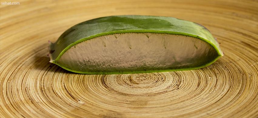 Aloe vera-Home remedy for skin itching in summer