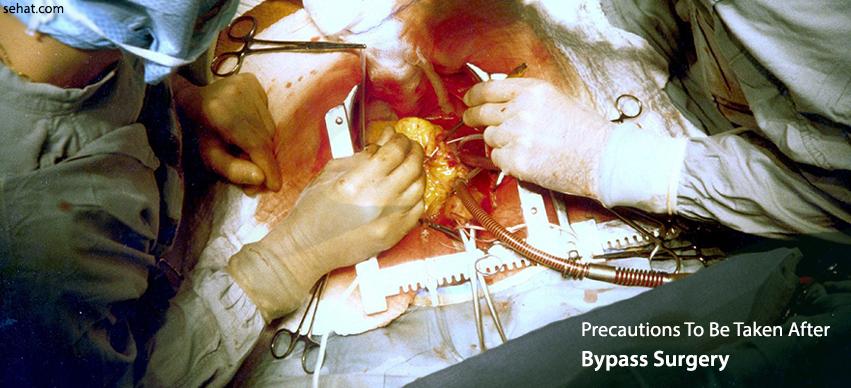 Precautions to be taken after bypass surgery