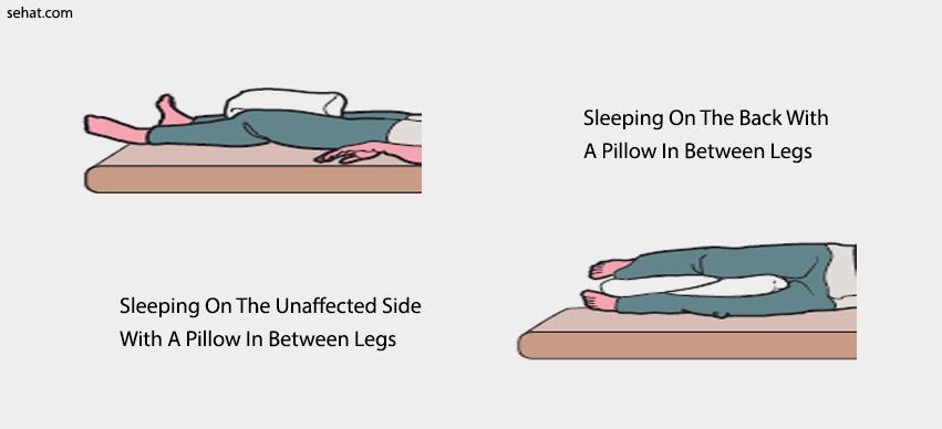 right sleeping positions to be followed after anterior hip replacement
