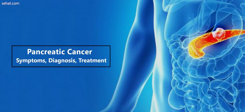 Pancreatice cancer-Symptoms,Diagnosis,Treatment