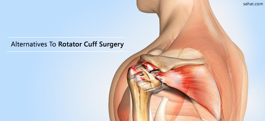 Alternatives to rotator cuff surgery