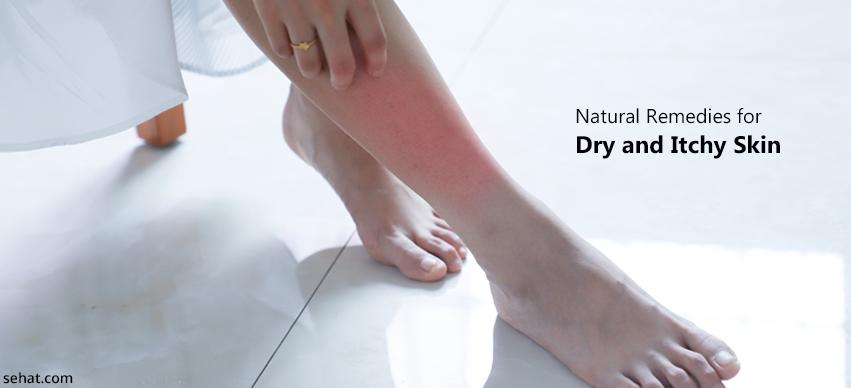 Natural Remedies For Dry And Itchy Skin