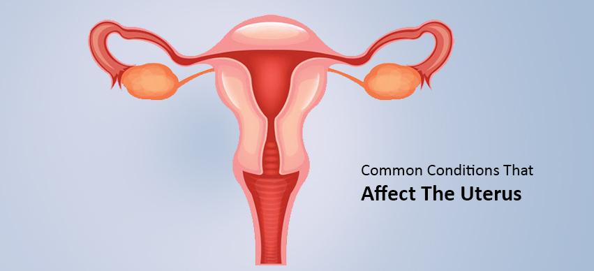 Common Conditions That Affect The Uterus