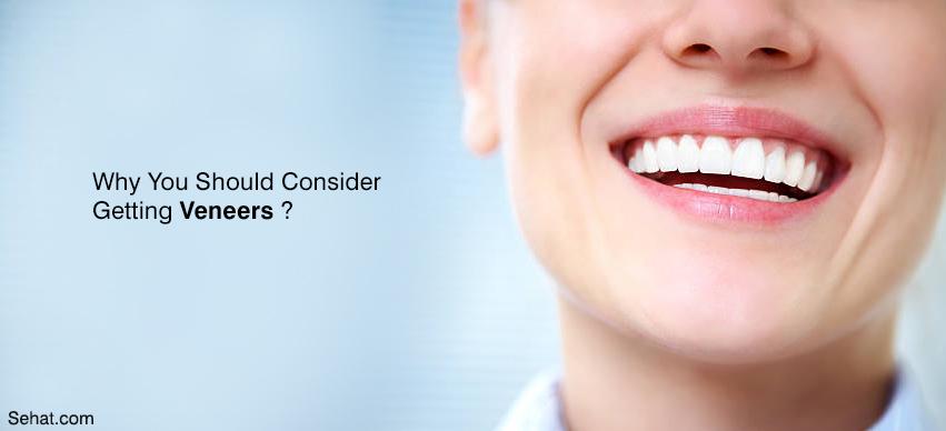 Why You Should Consider Getting Veneers