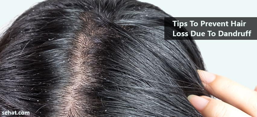 Tips To Prevent Hair Loss Due To Dandruff