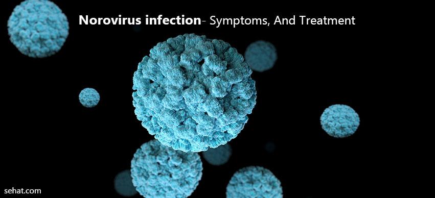 Norovirus infection- Symptoms, And Treatment