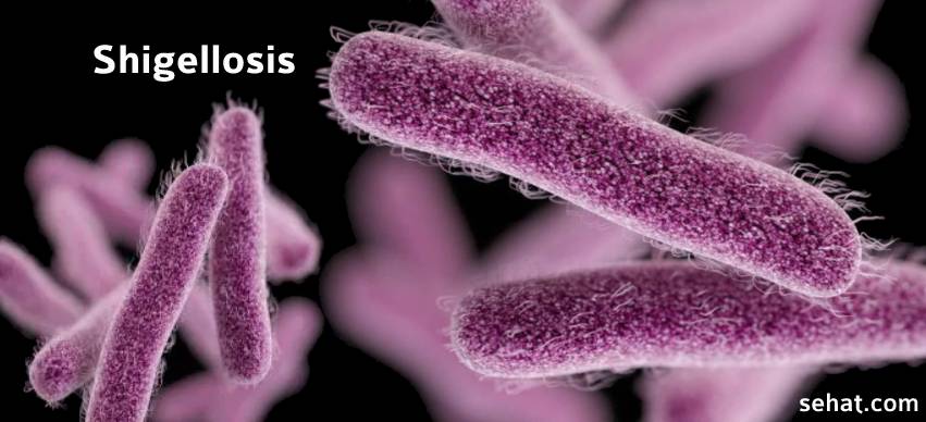 Shigellosis - A Foodborne Illness Caused by Shigella 'Superbugs' Bacteria