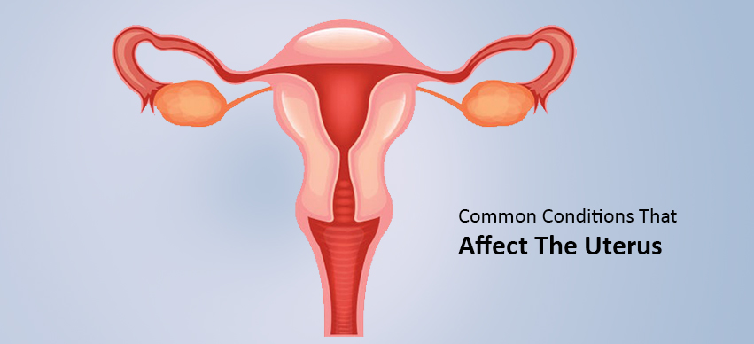 4 Common Conditions That Affect The Uterus- Which You Need To Know About