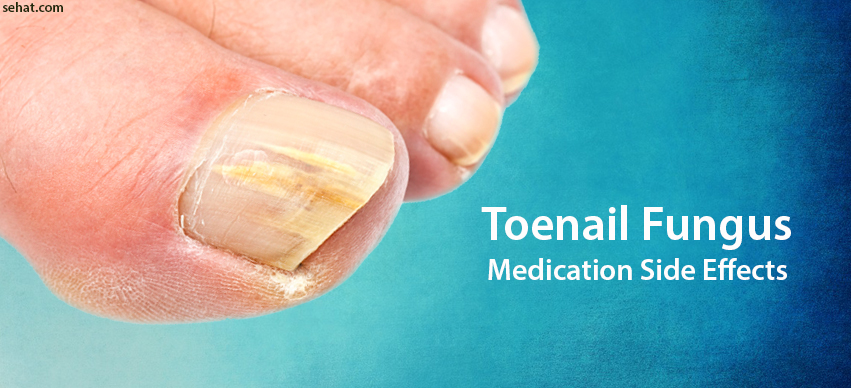 4 Facts about the Side Effects of Toenail Fungus Medication