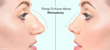 5 Things To Know About Rhinoplasty
