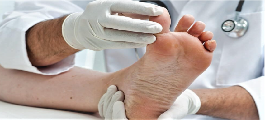 8 Tips for Diabetic Foot Care | Essential guide (2022)