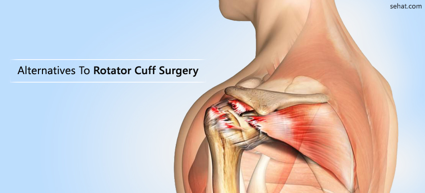 Alternatives To Rotator Cuff Surgery