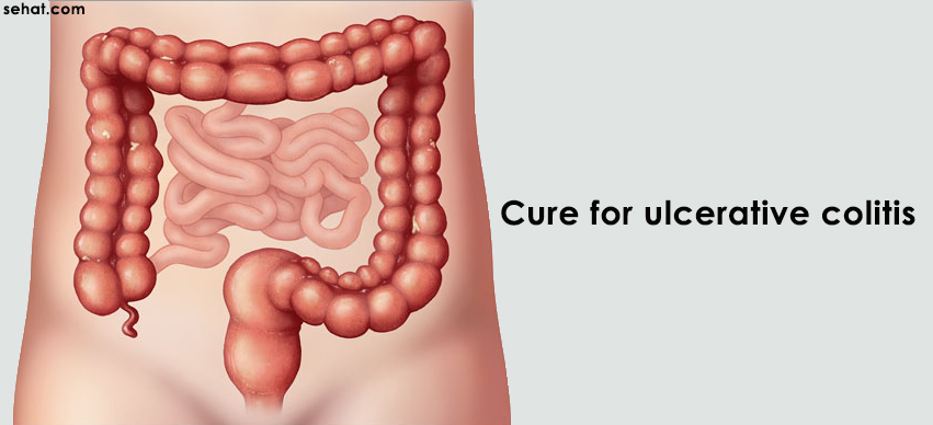 Cure for Ulcerative Colitis