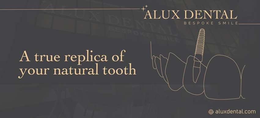 Dental Implants - Bringing The Lost Smile Back